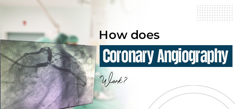 How-does-Coronary-Angiography-work
