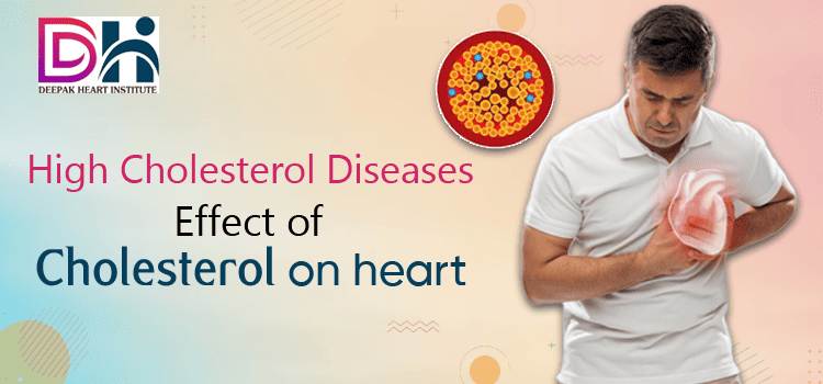 High Cholesterol Diseases, Effect of cholesterol on heart