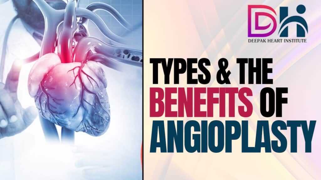 What is the definition of angioplasty?