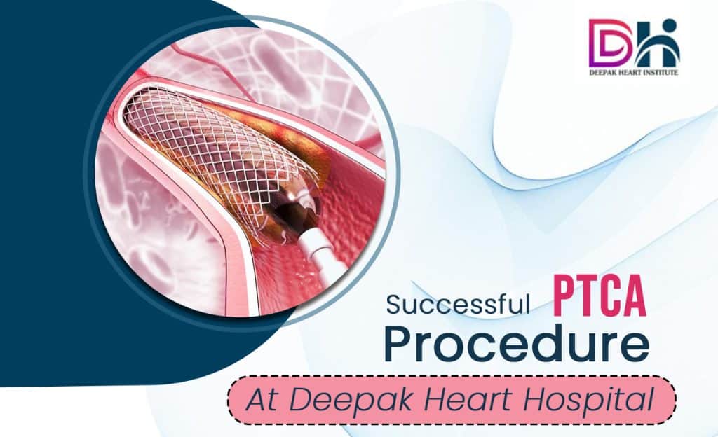 Successful PTCA Procedure At Deepak Heart Hospital